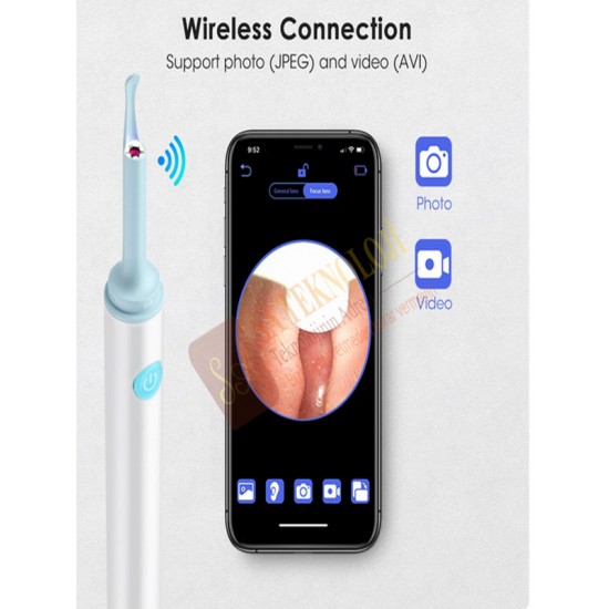 Kulak içi kamera ve kulak temizleme cihazı